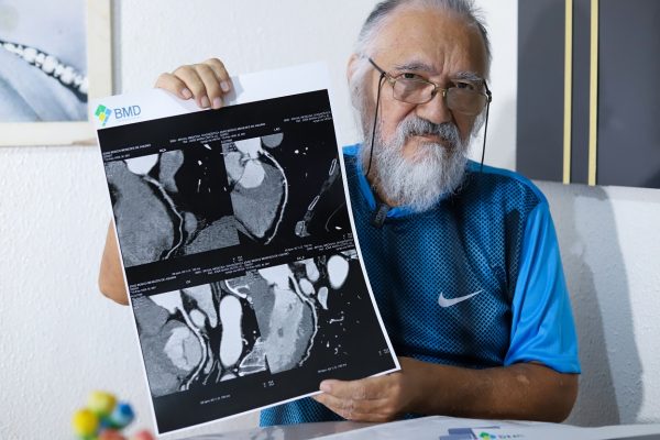 Após acordo com o governo, DPE-AM garante cirurgia cardíaca para homem que estava com 90% do coração comprometido